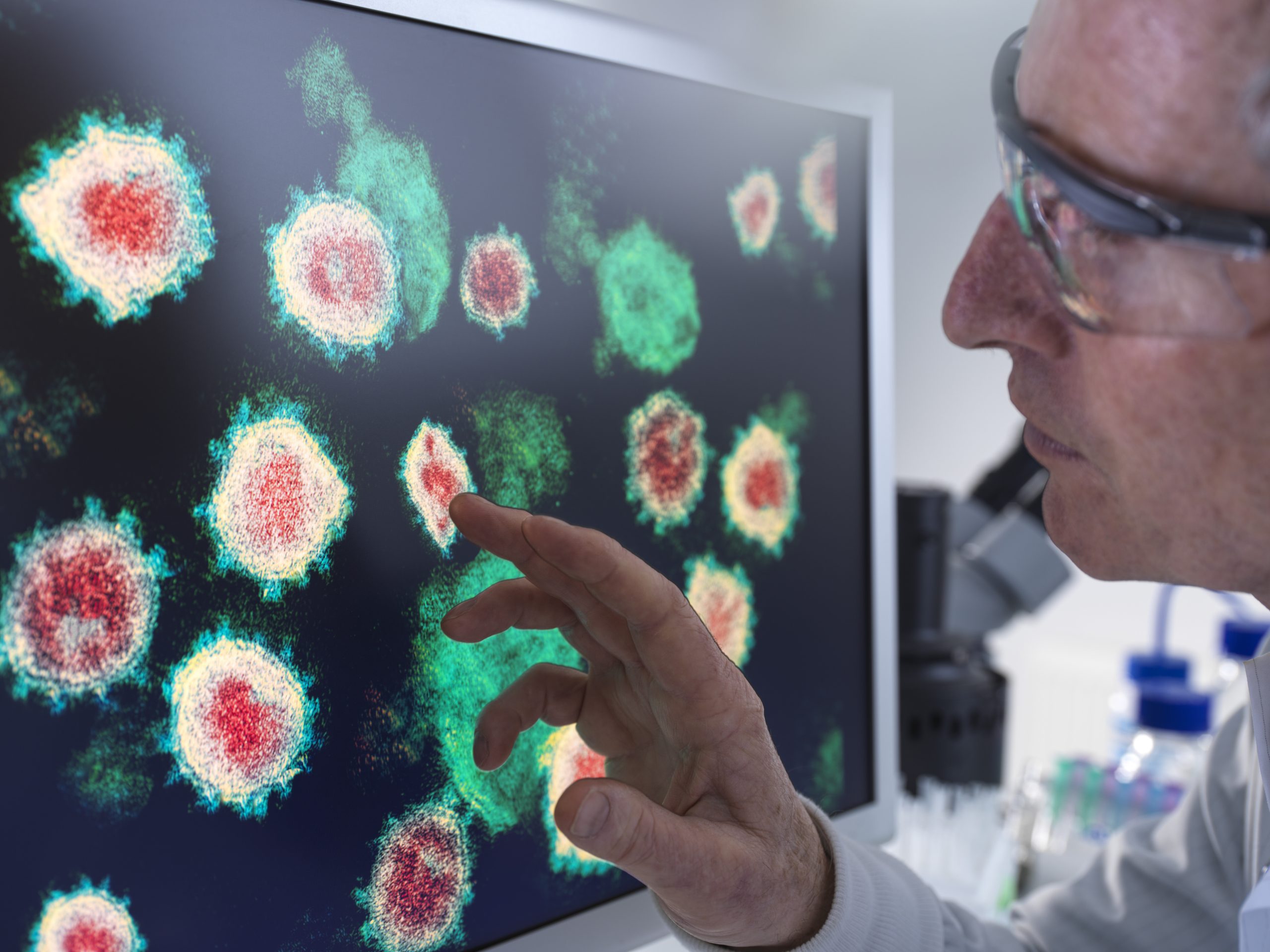secretome vs exosome neulife